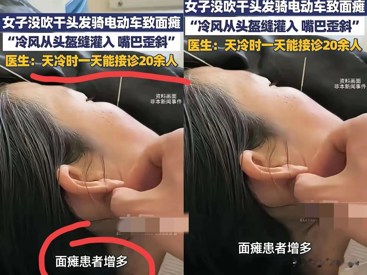 谁能想到洗个头的功夫，
居然把自己洗成了面瘫！
河南周女士的经历真的给
所有人敲