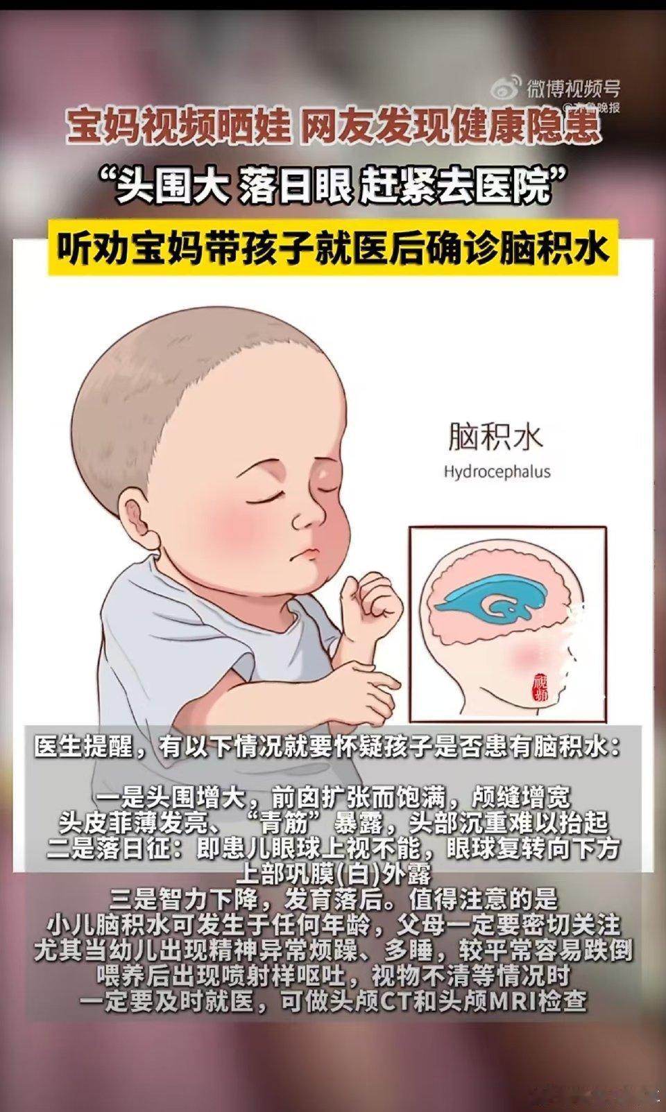 宝妈晒娃日常遭网友催去医院，当事人发声：看完评论后怕了
 
网上晒娃本是分享幸福