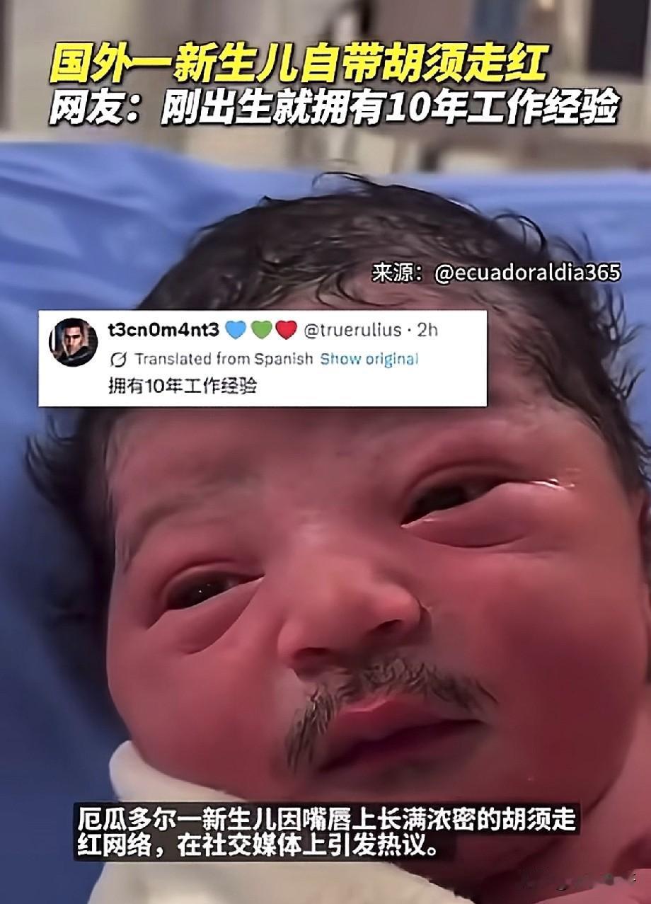 厄瓜多尔新生儿自带浓密小胡子火出圈！网友调侃：刚出生就有十年工龄
 
近日，厄瓜
