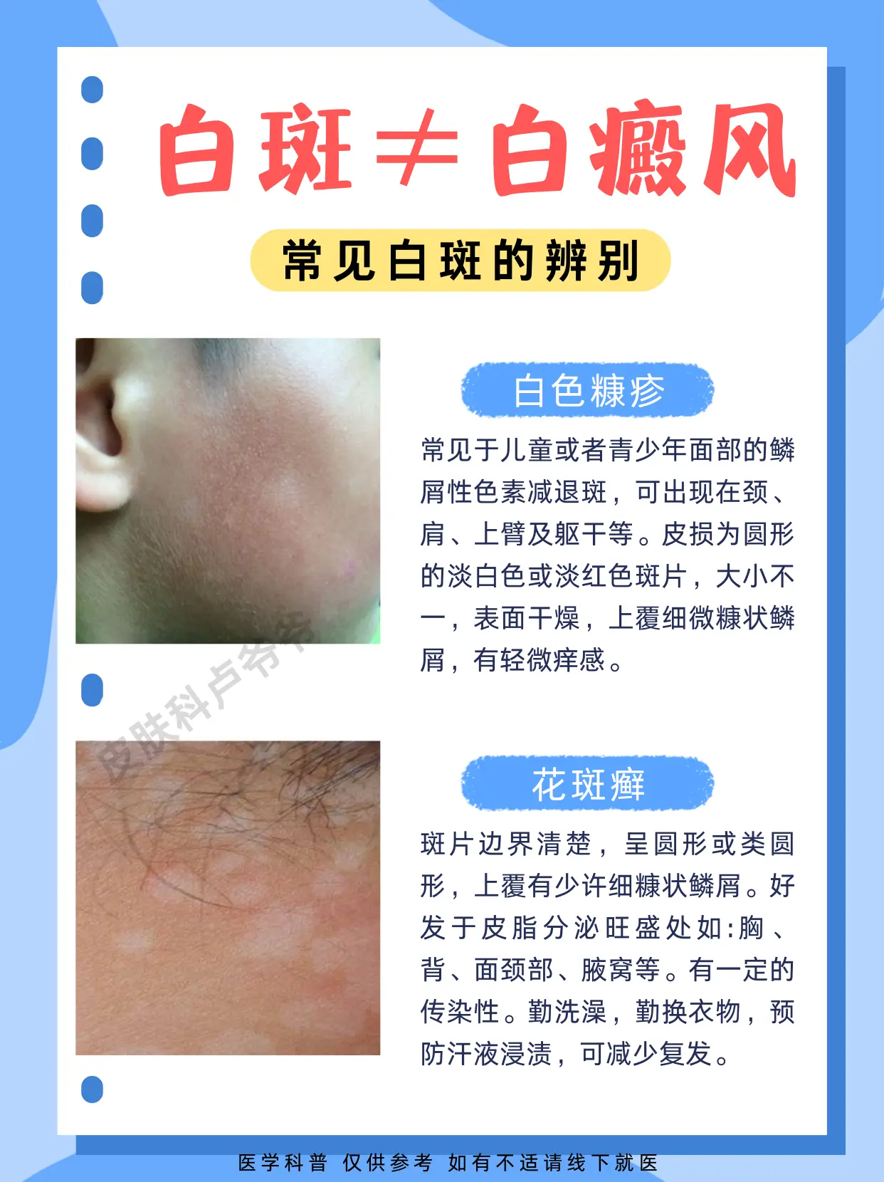 这几种白斑别搞错了