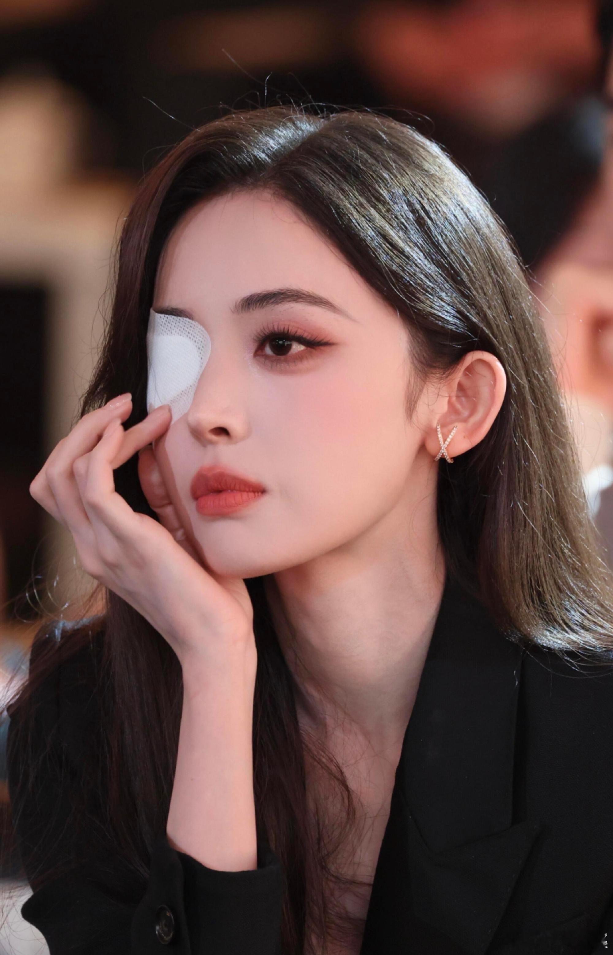 娜扎称眼睛恢复情况不太妙眼睛怎么了 