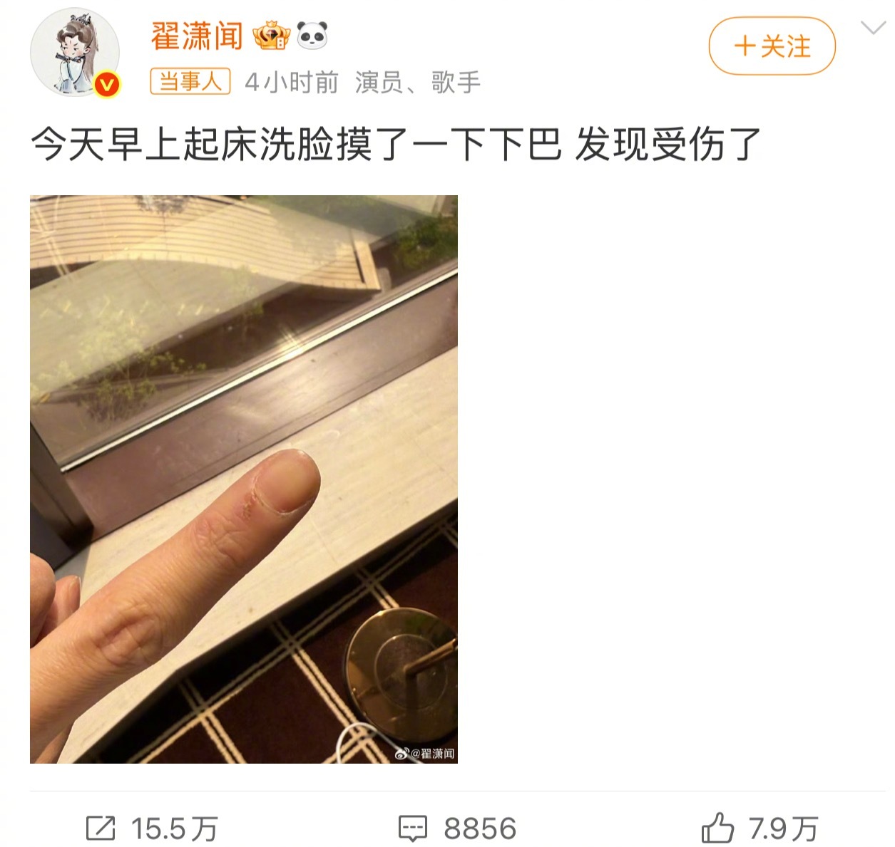 翟潇闻摸了一下下巴受伤了怎么个事 一脸担心的来 又被翟潇闻的梗给骗到了[doge