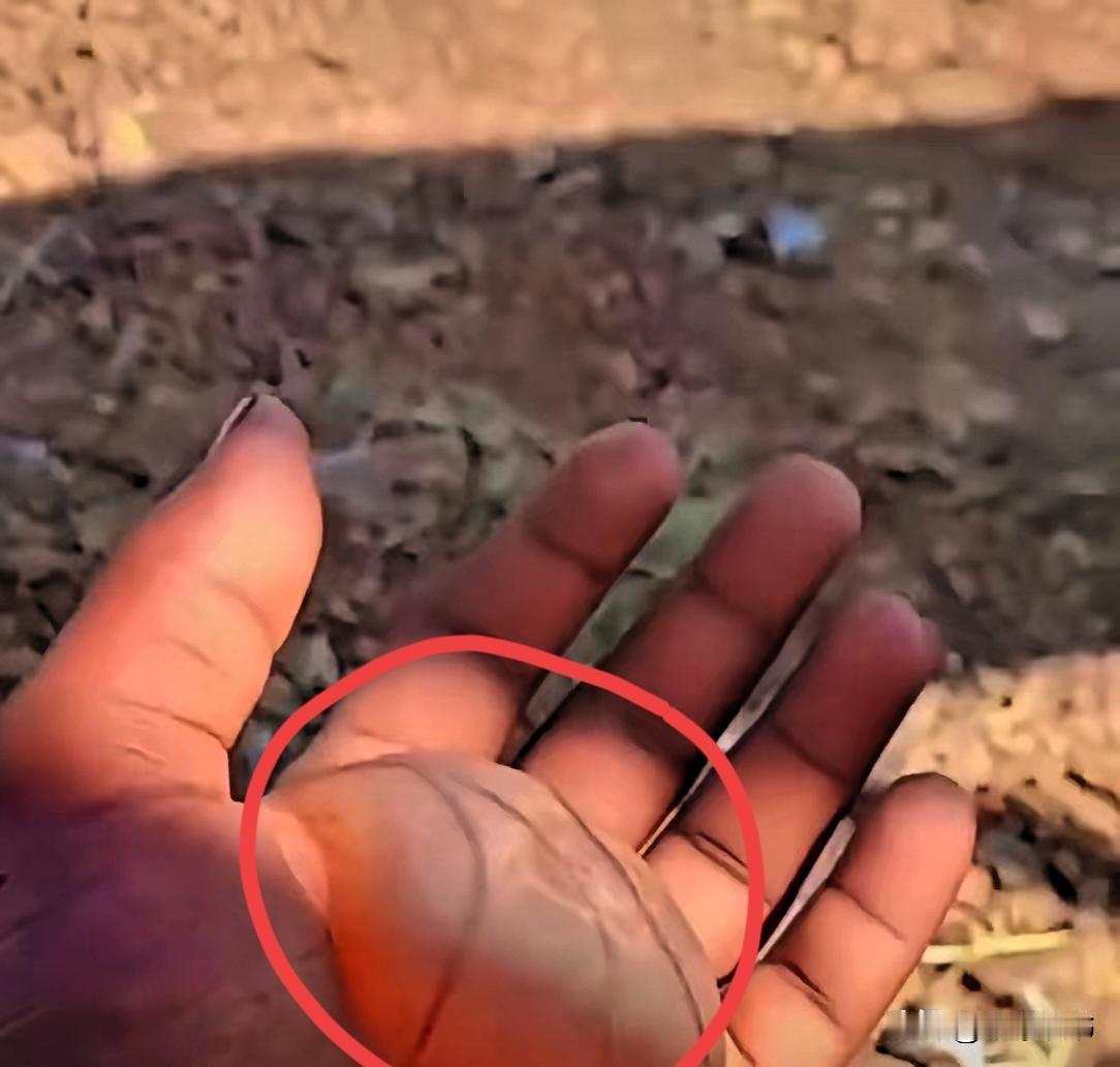 贵州一女子爬完山，突然发现手握不住拳头，低头一看吓了一跳，只见掌心鼓起一个巨大的