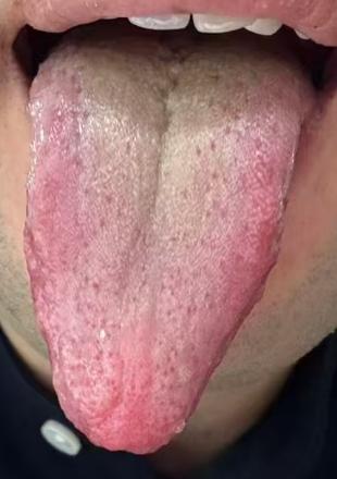 养好海绵体只需三招，补足气血畅通宗筋





有不少男同志到了中年就出现了功能