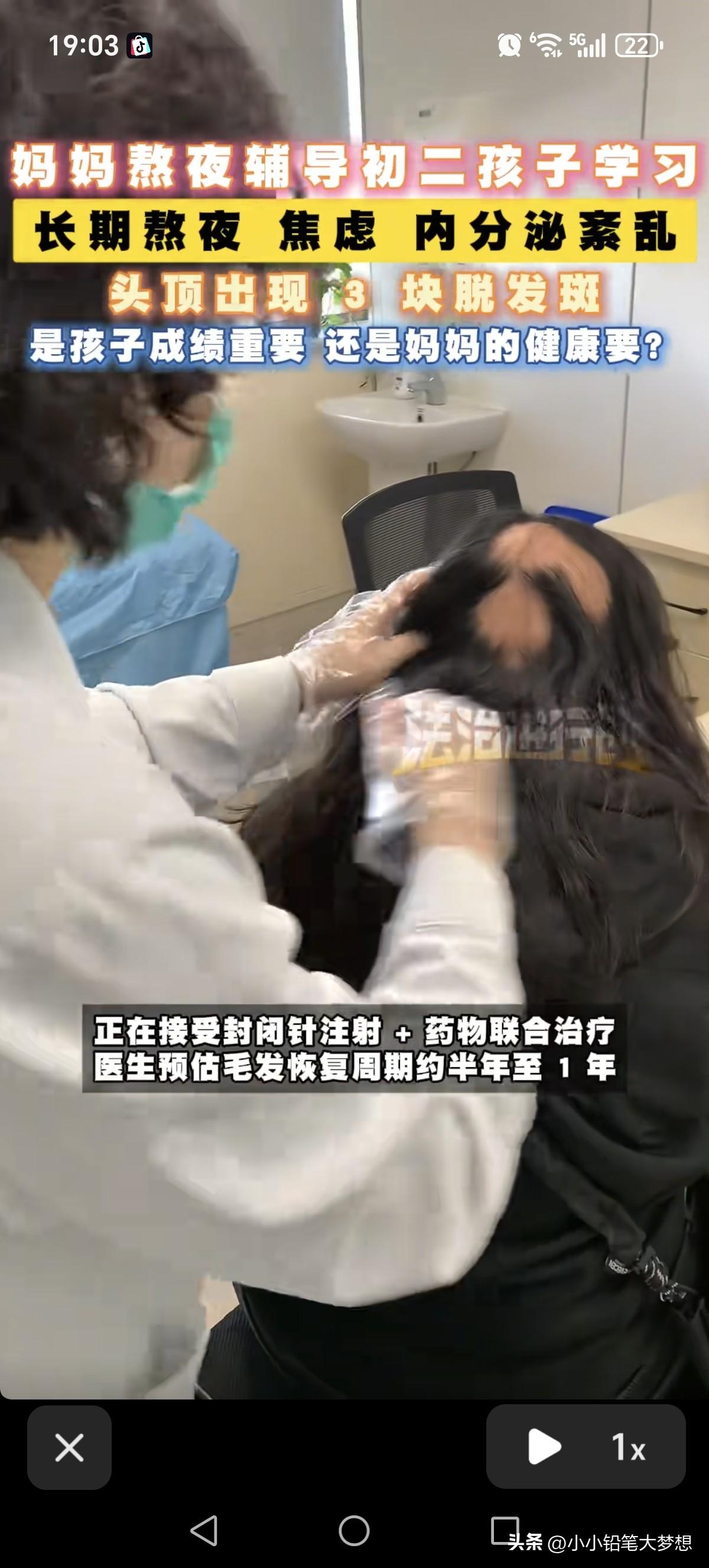 吓死，这就是传说中的“鬼剃头”了！这是江苏苏州的一位95后的全职宝妈，她的头部出