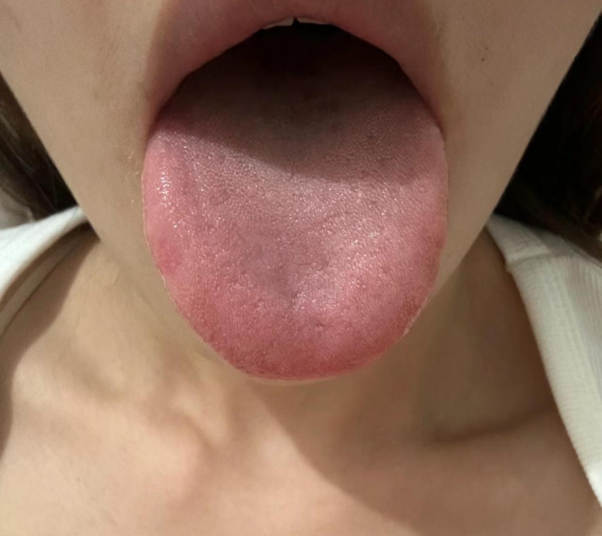 上热下寒，中焦不通，容易上火，总是长口腔溃疡，气血不足，湿气重年马桶，失眠多梦