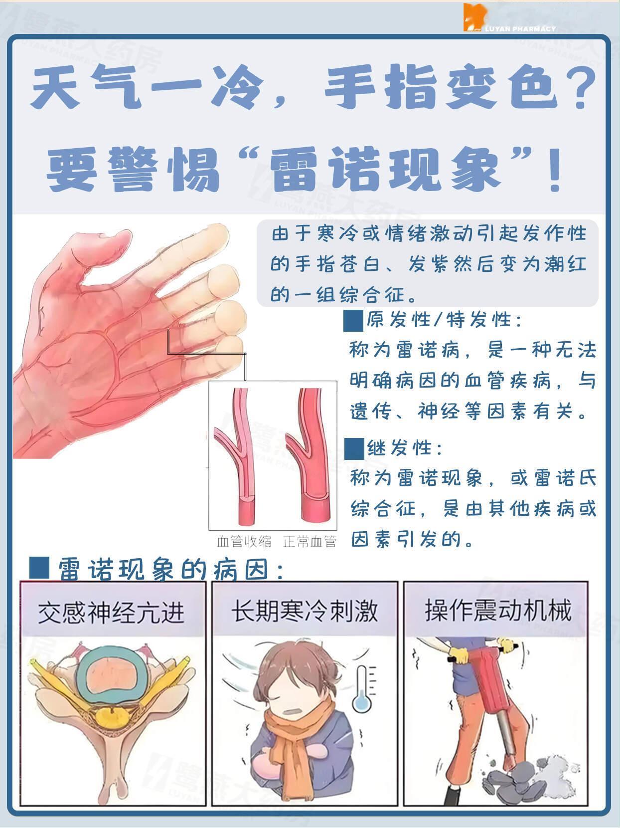 跑完步手指突然变成了白色 手指变色🖐️警惕‼️雷诺现象‼️自查➕方法👆👆 