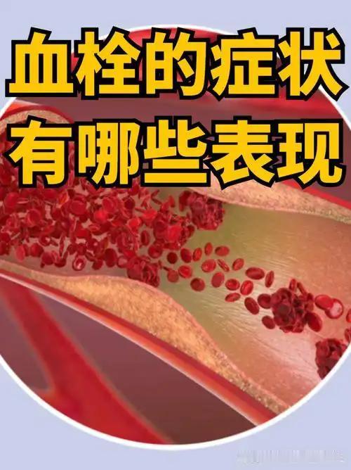 之前总觉得血栓是突发急症，不会有提前征兆，看完才明白晨起的各种不舒服都是身体预警