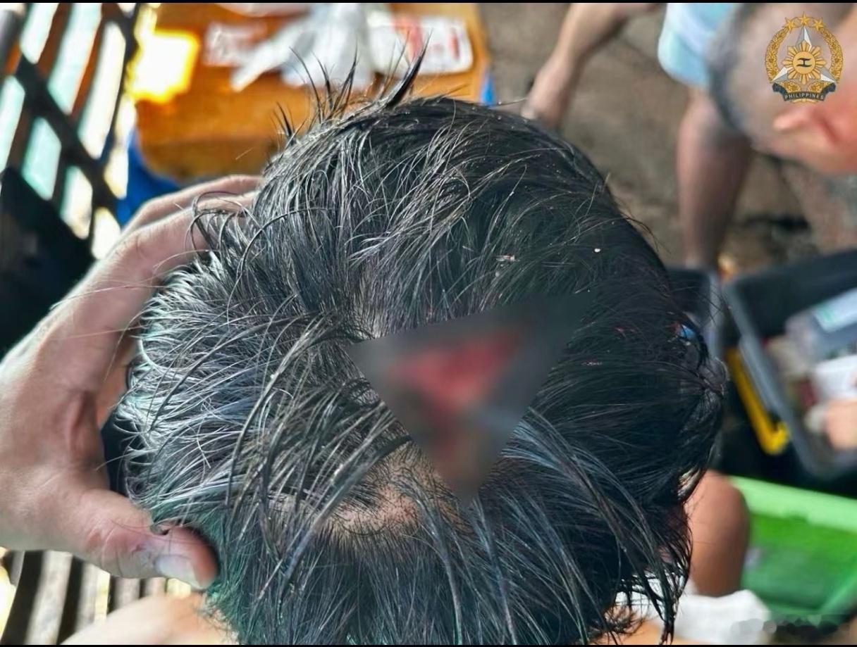 忍无可忍了，菲律宾的胡闹该结束了菲猴破瓜烂瓢  我不管，只盼我方毫发无损！ 