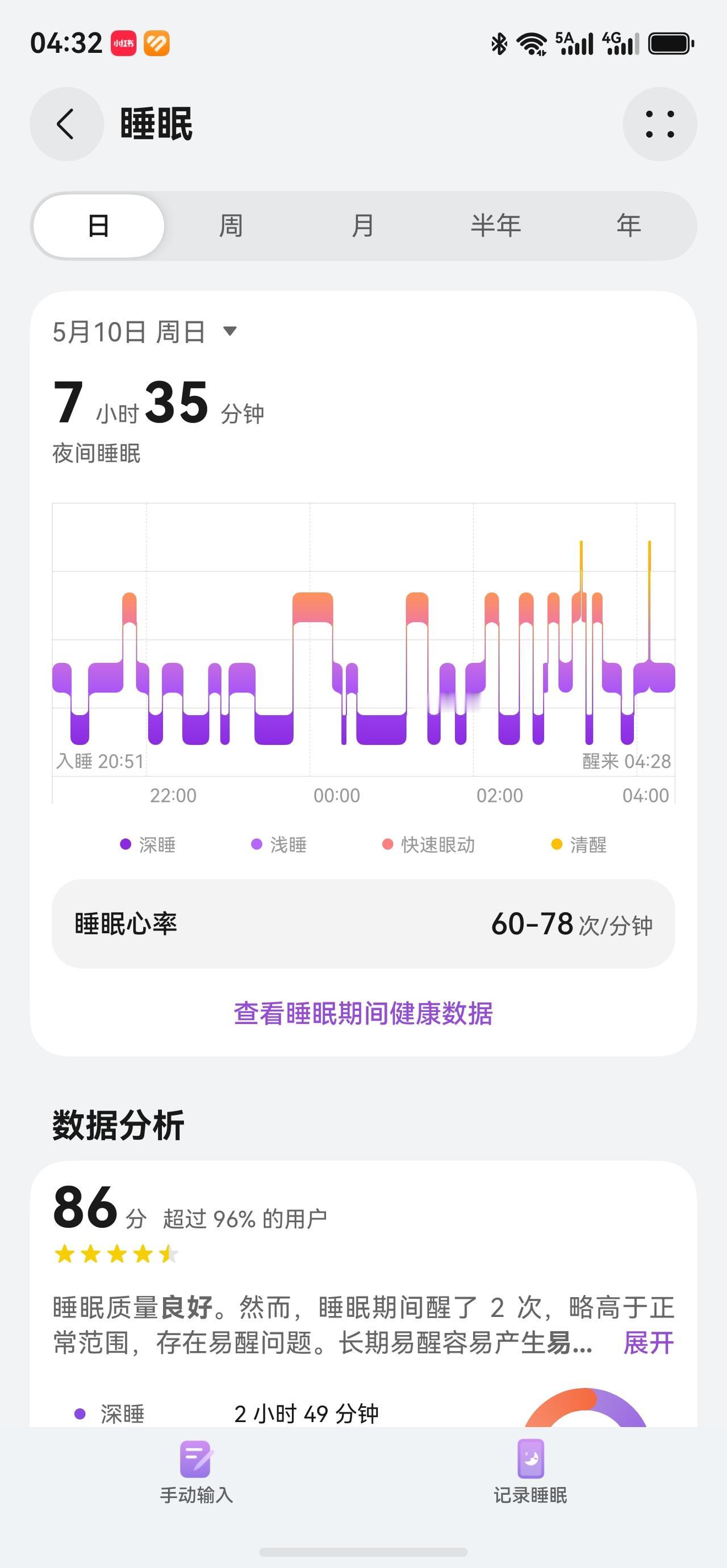护士日记第二篇
昨天晚上睡觉早，破天荒的20点左右。凌晨3点半左右清醒。

姑父