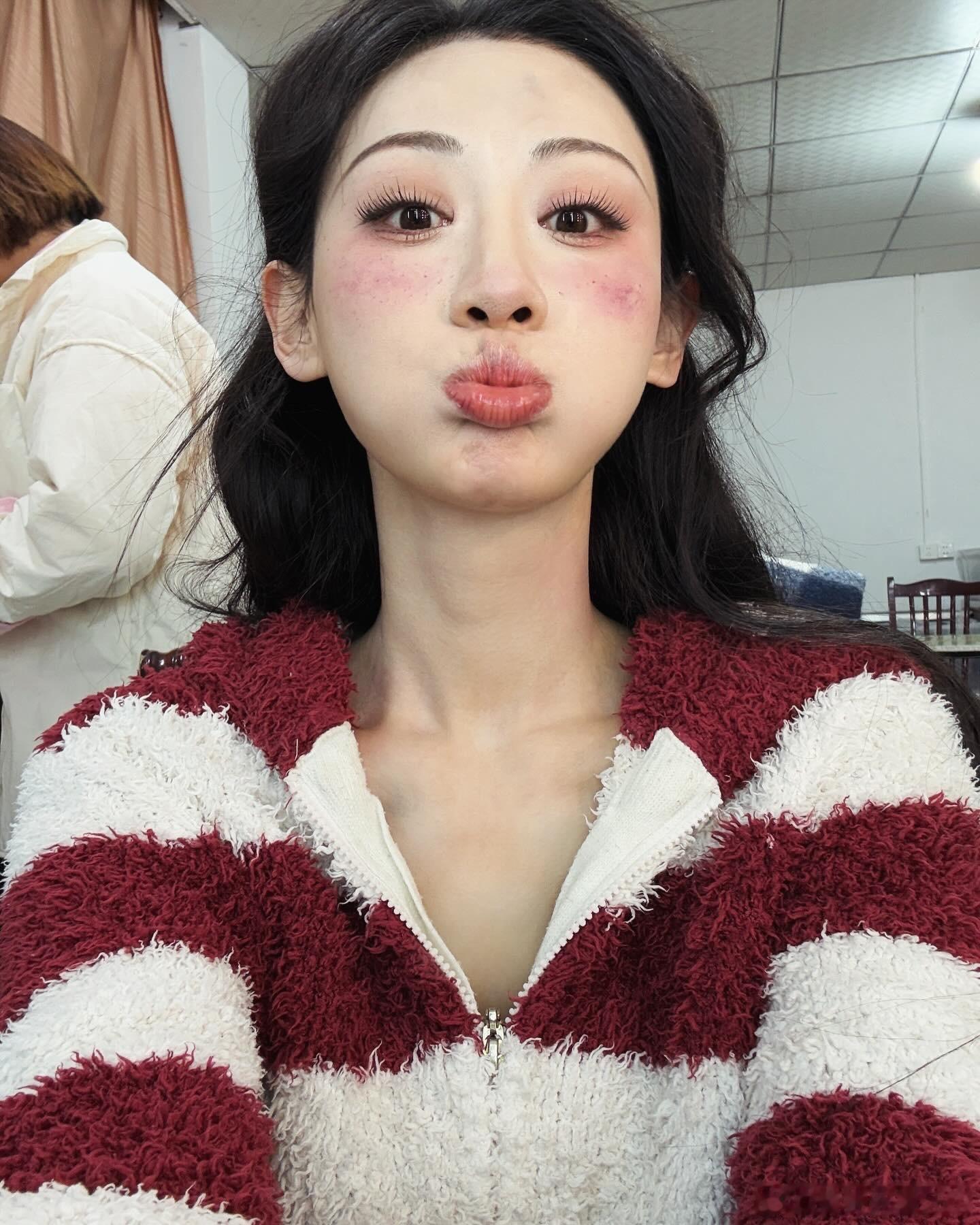 [举车]你的牙突然出现一下  