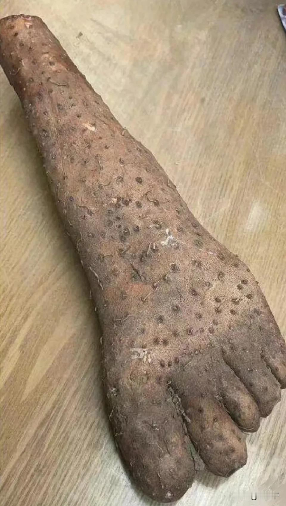 还得是中医，治好了我的L足癖