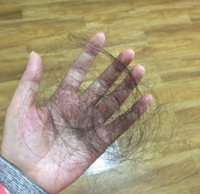 倪海厦说：脱发是大肠有浊毒
 
1. 脱发与中医理论的关联
在中医理论中，脱发不