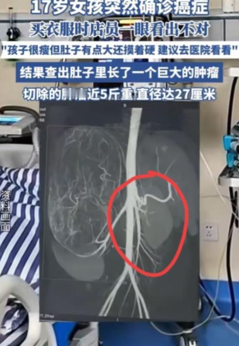 2025年6月，广东17岁女孩和妈妈一起逛街买衣服，在试裤子的时候，老板娘发觉女