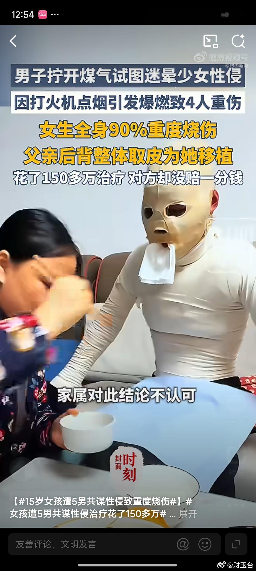 15岁女孩遭5男共谋性侵致重度烧伤很难想象在当下法治社会，还会出现五人提前串谋，