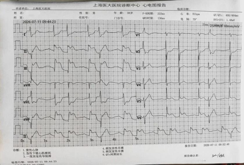 高温天"心梗vs中暑"识别口诀

一看汗：

中暑出热汗，浑身湿透透；

心梗出