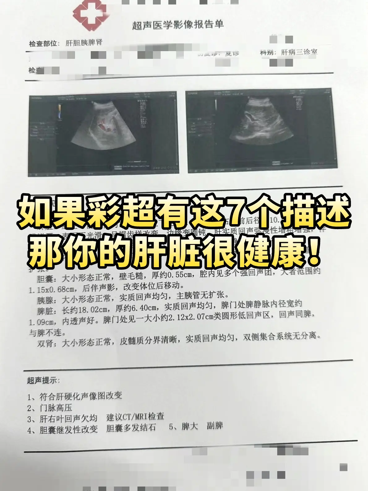如果彩超有这7个描述，那你的肝脏很健康！1、肝脏的体积，长度和大小正常...