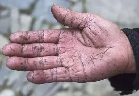 这么多年，没看到有勤劳致富的，勤劳致残的倒是不少，你比方说工人在机械作业的时候，
