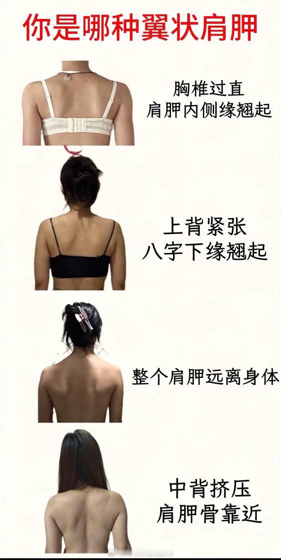 还是蛮感叹的，昨晚仔细看了胖胖的骨架，感觉我养的还行，真牛啊朋友。扁平足还是扁平