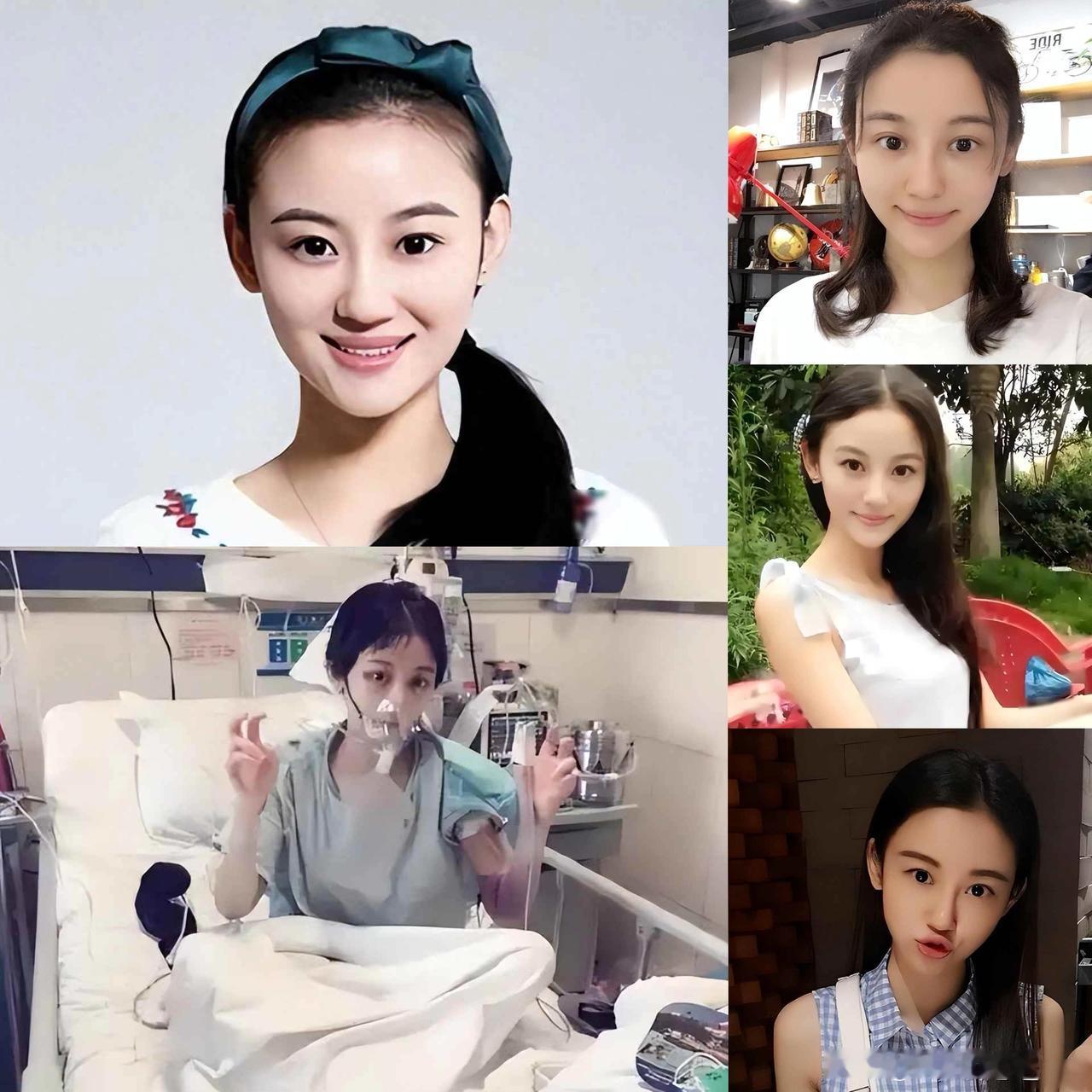 原来她早已去世！
26岁全身溃烂不治而亡，
被全家8口“吸血”多年！

说起徐婷