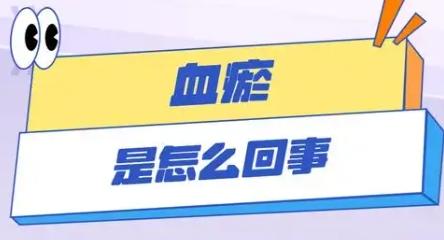 瘀在头——川芎，瘀在胸——丹参，瘀在肝——香附
 
首先是血瘀在头部
头面部有瘀