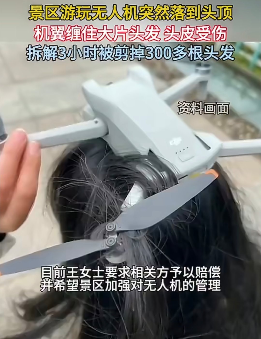 女子景区被无人机缠头发被迫剪掉这。。。。。。。被剪掉300多根头发这女子应该会很
