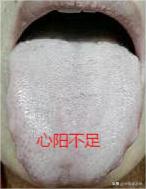 夏季补阳一年不慌，分享3个厉害的补阳中成药，把阳气补到骨头缝
1.柏子养心丸
功
