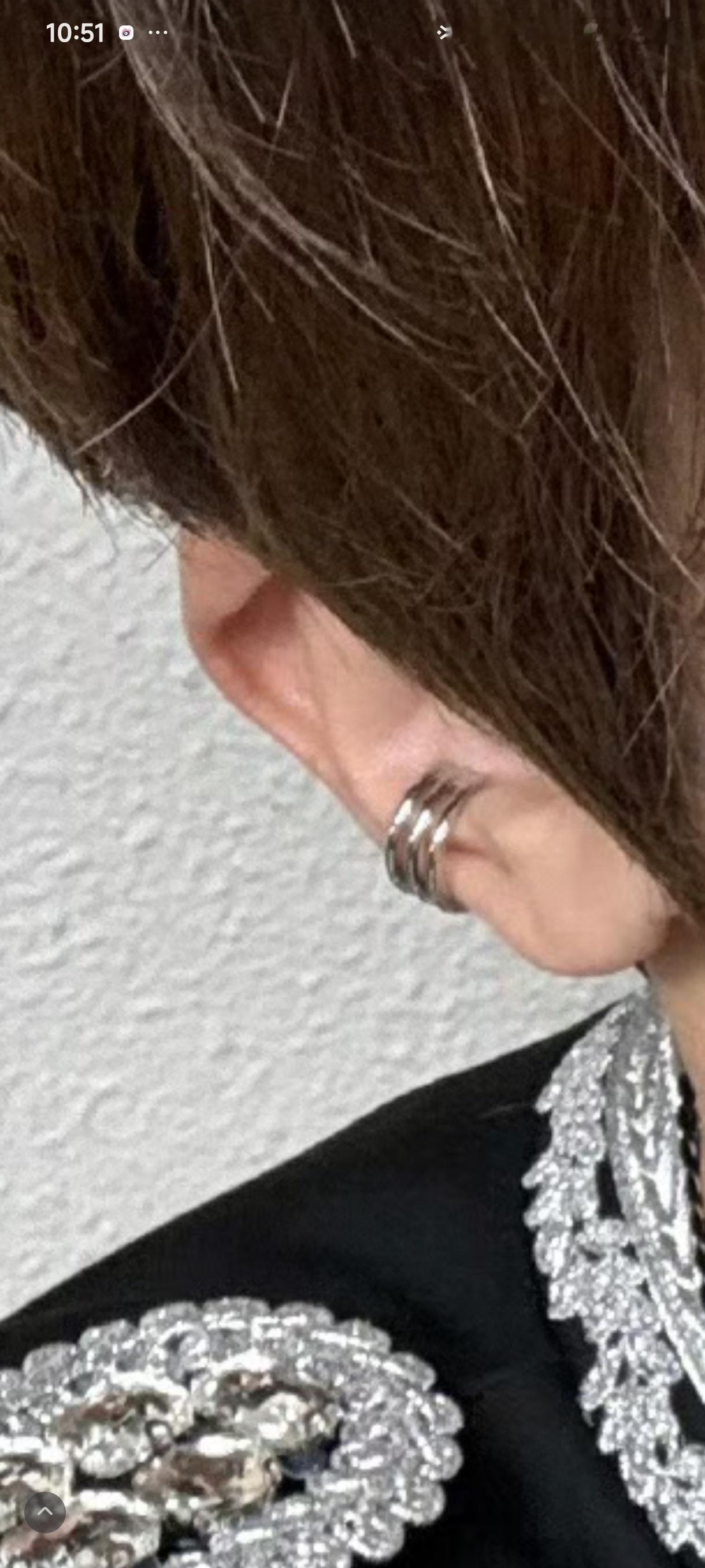 这个位置是耳蜗吗 