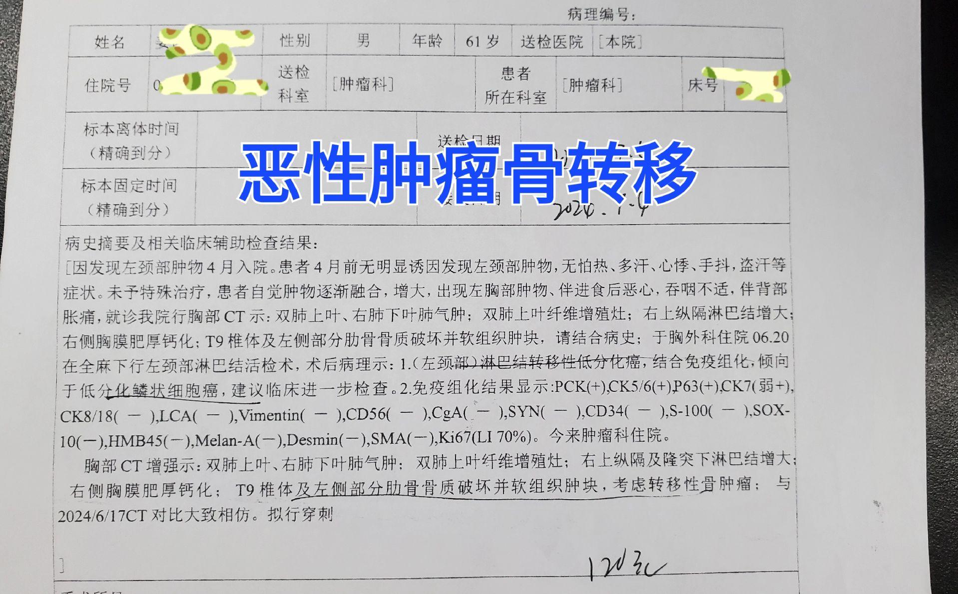 骨转移