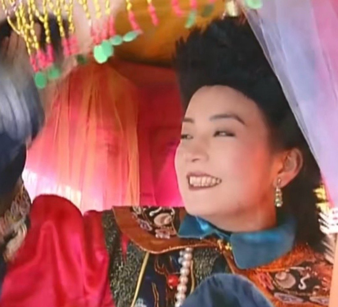 为啥70后的演员多数都有四环素牙？ 