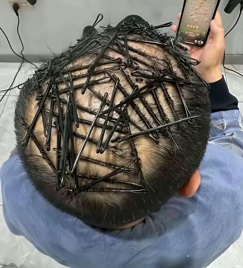 如果剪光头，效果可能会更好一些，稳重又霸气。你这几根发丝，还专门搞个卷发，不仅委