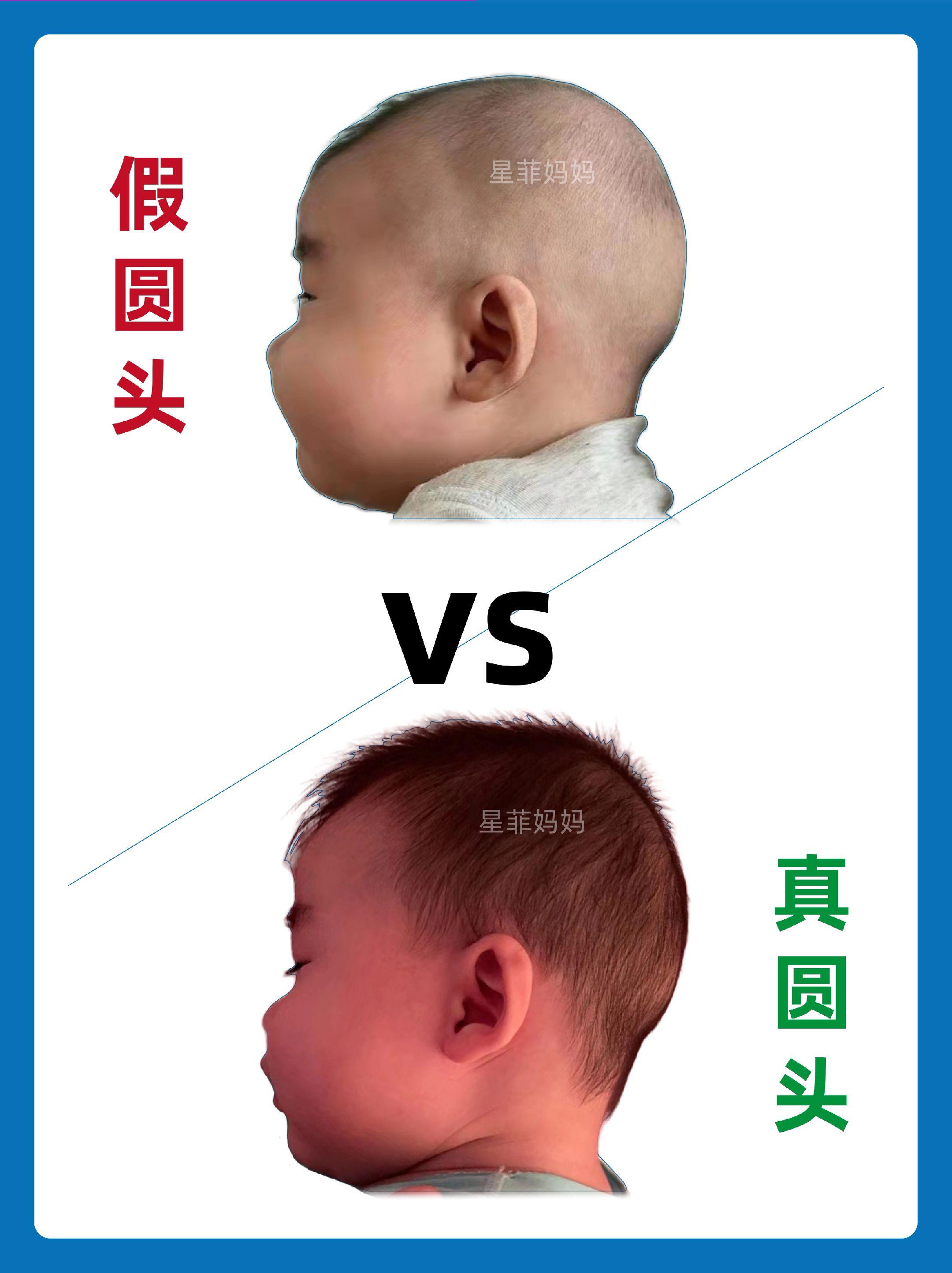 不要睡假圆头要睡真圆头。