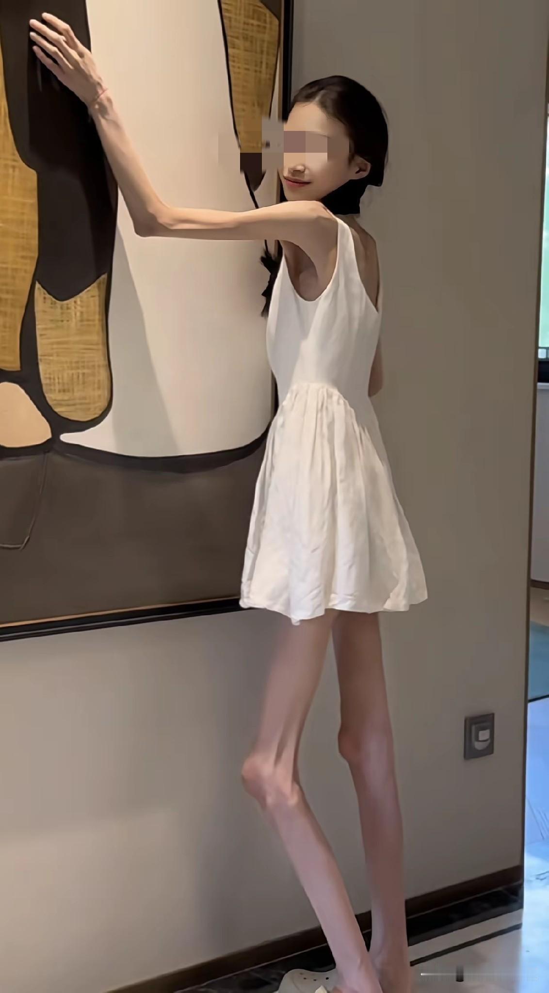 瘦到这样的程度真的好看吗？我真心觉得没有感受到一点美的存在，反而感觉到有些病态，