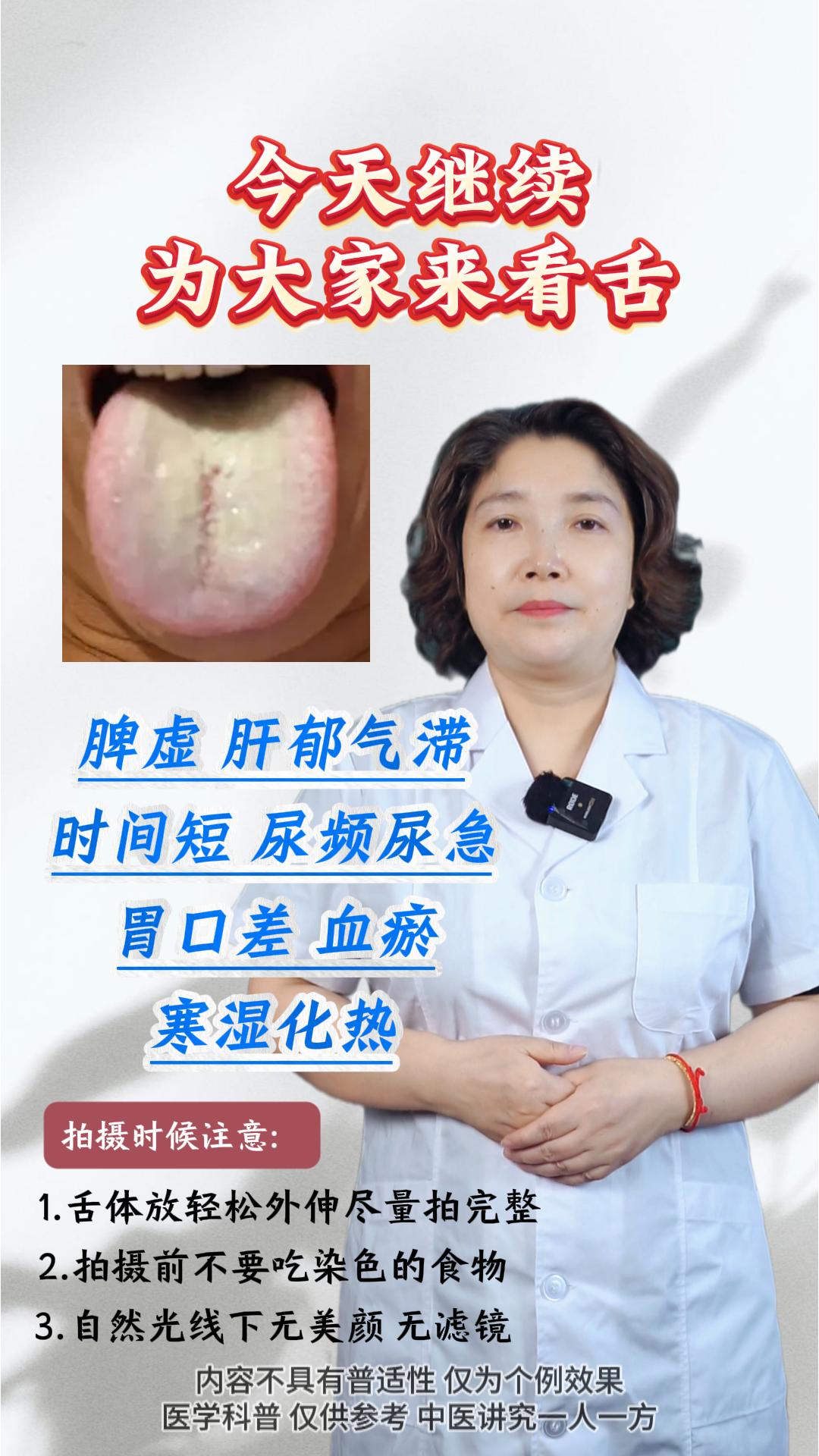 中医 舌诊 医学科普 调理身体 医者仁心