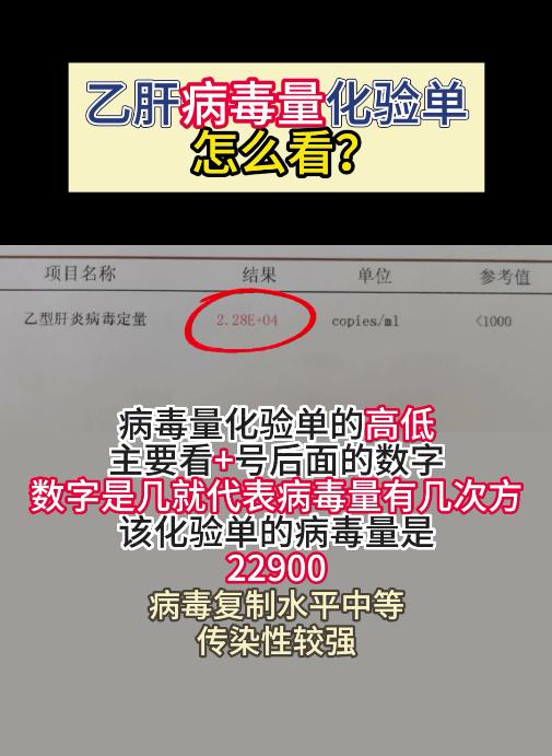乙肝病毒量化验单怎么看？。
