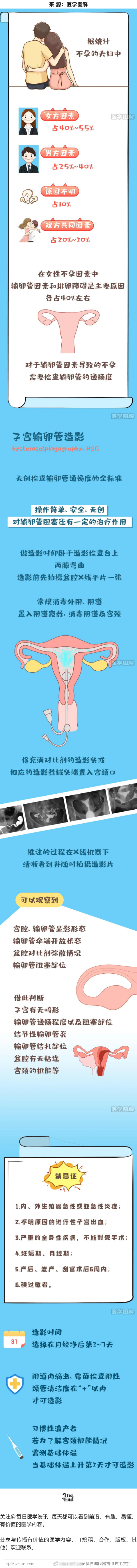 #医学图解# 一图看懂输卵管造影 ​​​
