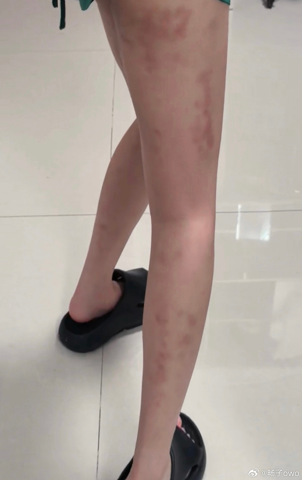 吓哭了 泡沫滚轴还有狼牙棒滚的 对自己就是如此之狠 我妈说我没救了 不知道的以为
