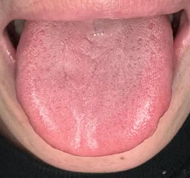 肺肾阴虚就别做这几件事了，这个小伙子让人生气，肾都被折腾成这个样子了，晚上还是不