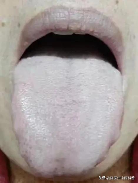 补肾最高境界：补肺金以生肾水！
 
张仲景肾气丸真正玄机：肺为水之上源，金能生水