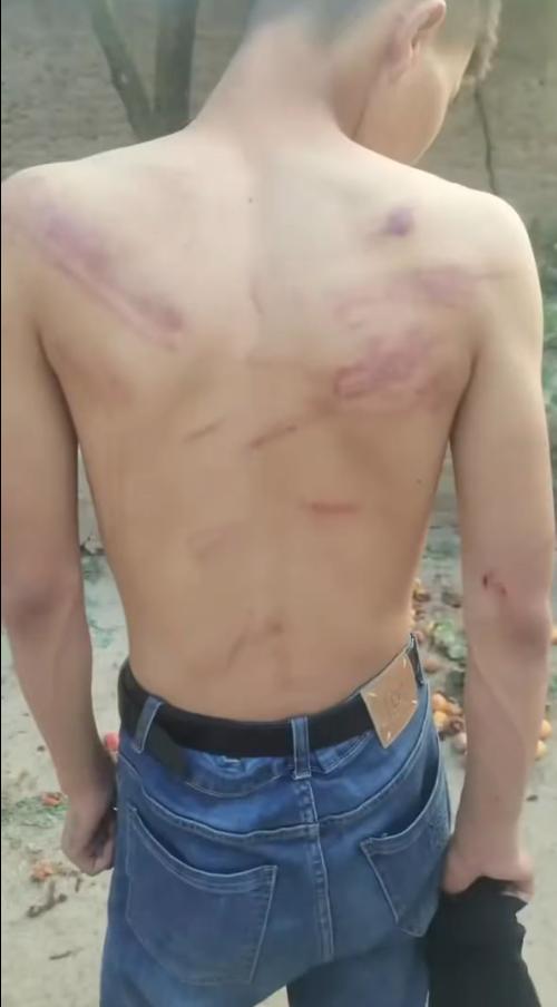 甘肃天水，14岁初二男生被同学以“找人打架”为由骗进出租屋。随后，3名同学持棒球