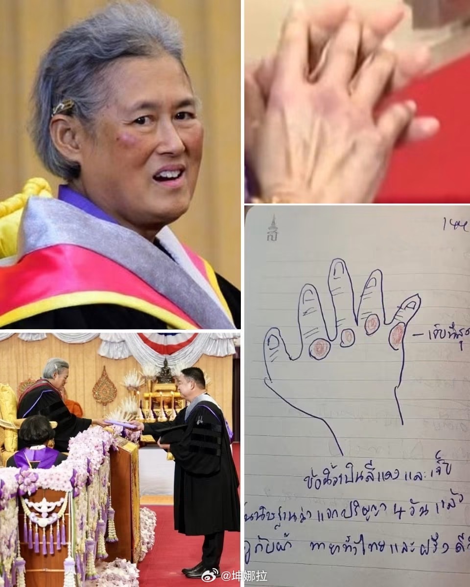 诗琳通公主画下手部伤痕 又是一年毕业季！泰国诗琳通公主曾连续4天主持毕业典礼、为