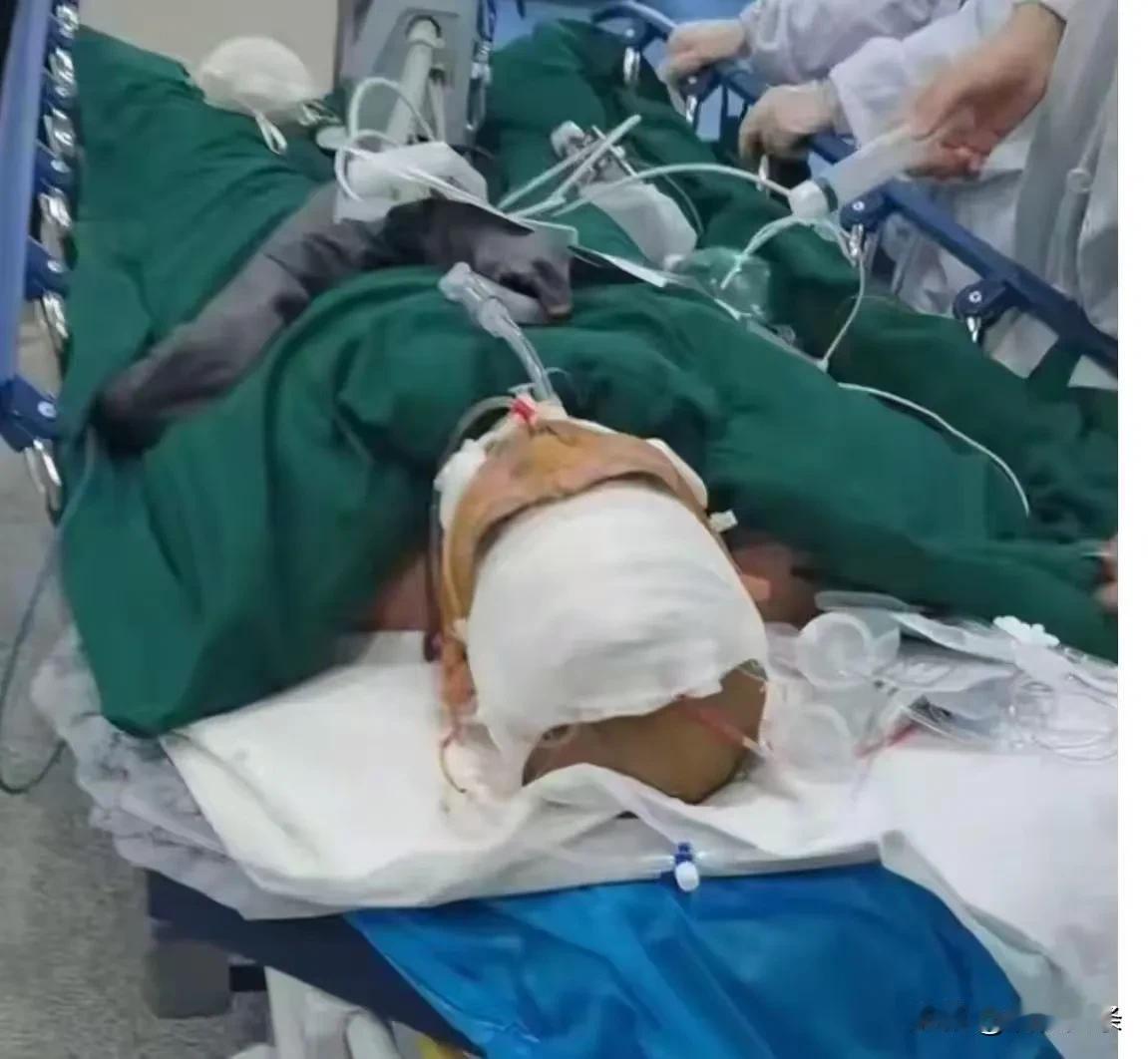 这起事故像一记沉重的闷棍，狠狠地击打在每一个关注这件事的人心上。原本只是一场普通