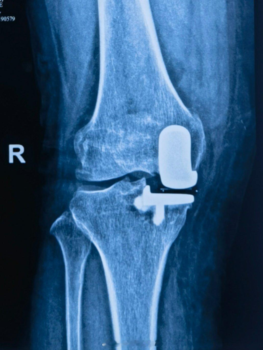 门诊和撸铁是最配（lei）的，毕竟讲一天话、撸一中午铁后你是身心俱疲啊… ​​​