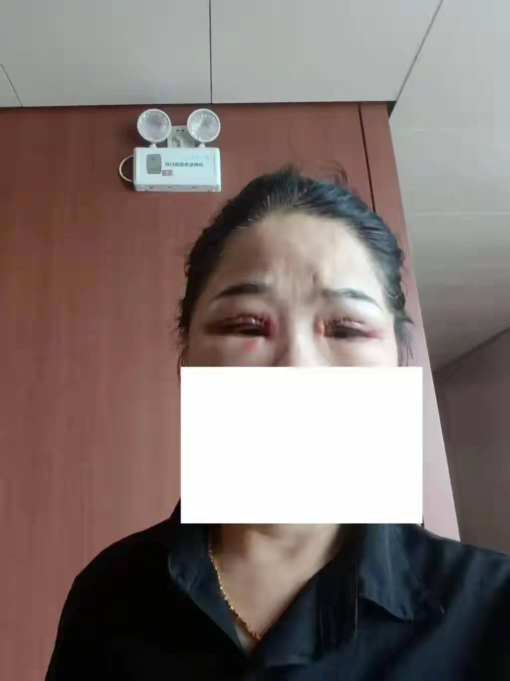 “都是满满的套路！”广州，57岁保洁大姐的微信里跳出一则医美广告，只要600元钱