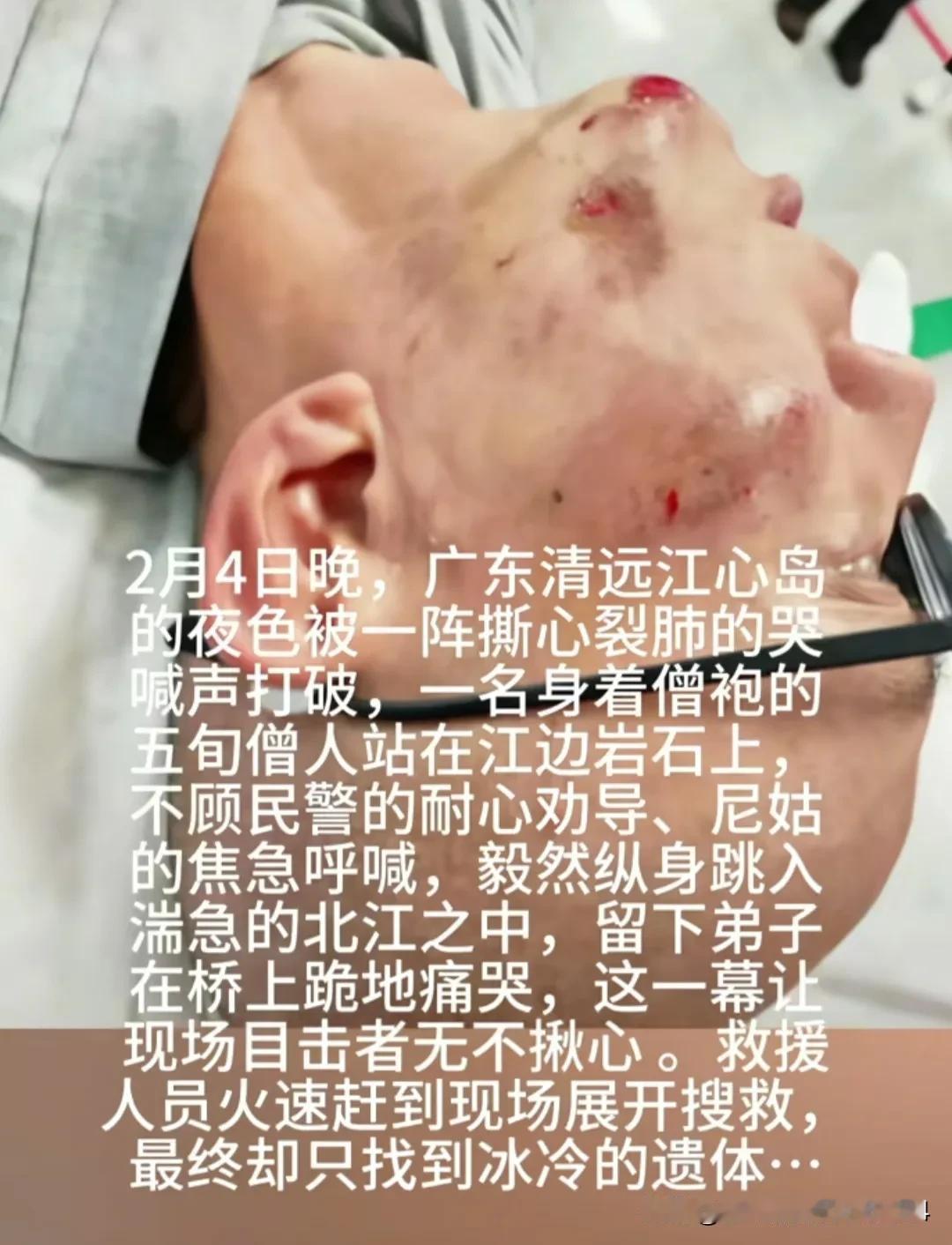 扶灯大师遗体已经打捞上来了，看着他脸上的多处伤口，能想象到他当时是多么无奈与决绝