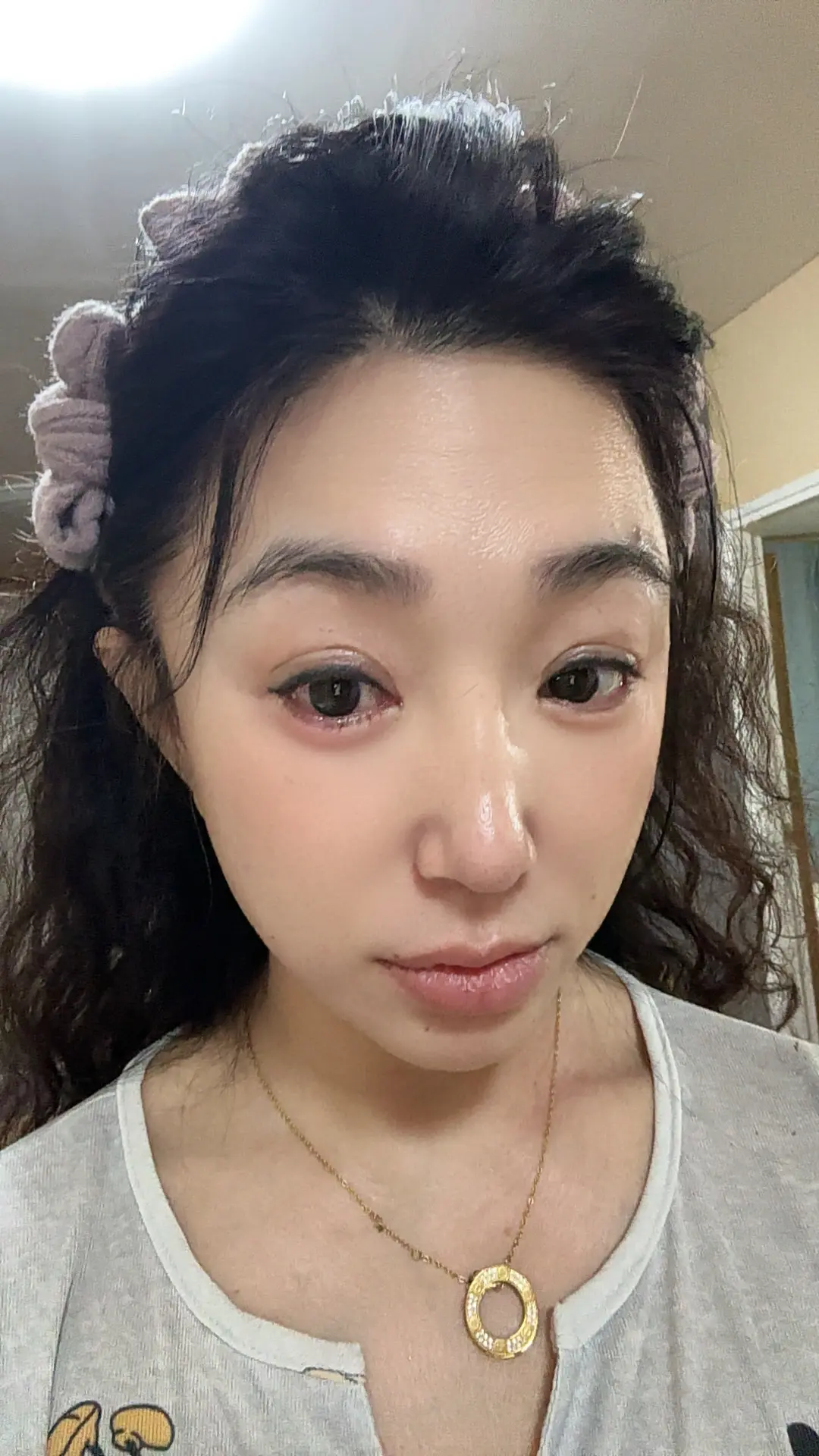 上个月做睫毛导致我眼睛红肿，老难受了😄