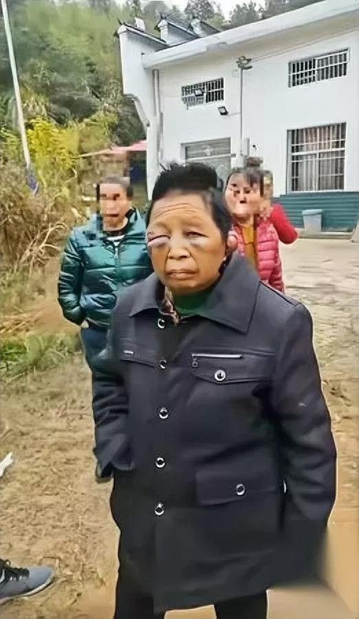 40岁大姐像60岁！谁把她逼成这样？村民曝光的画面让人心颤……湖南平江这位大姐，