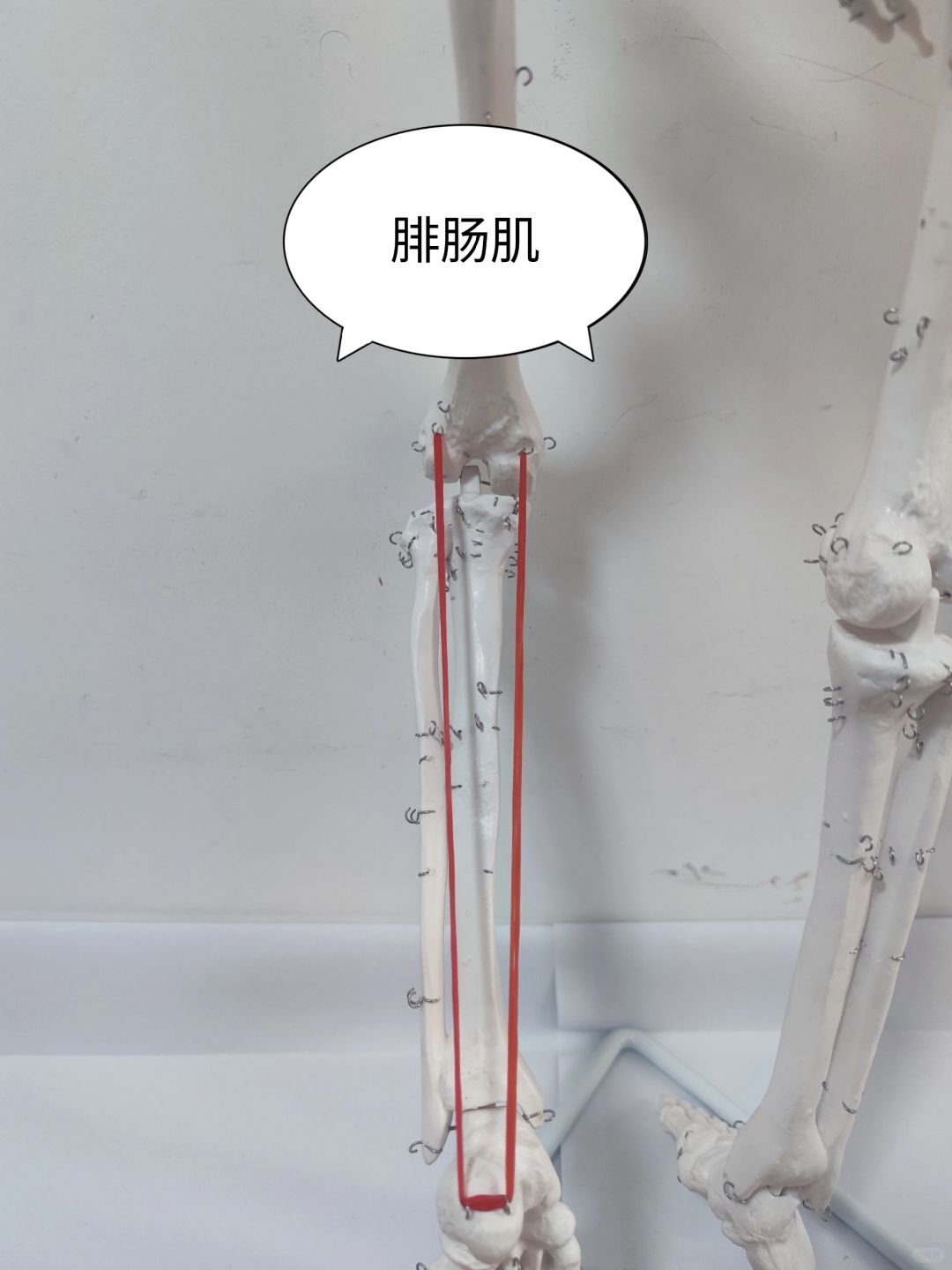 腓肠肌