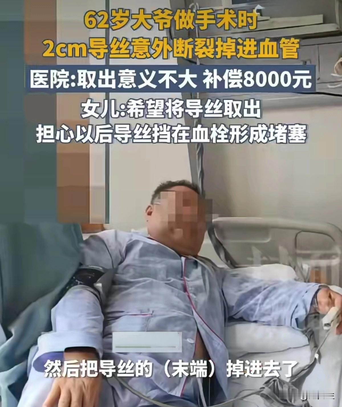 导丝断留血管！
一根细小的手术导丝，本应是救命的工具，却意外断裂，残留在了62岁