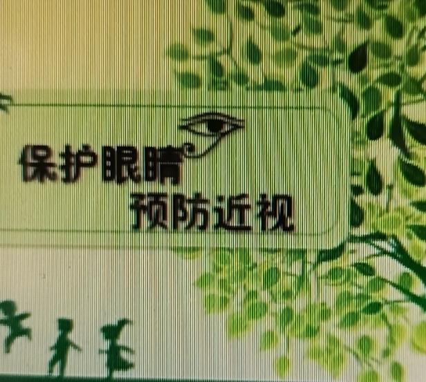 现在大家用眼过度，眼睛问题越来越多。分享几个护眼小知识。
平时可以做睫状肌“点赞